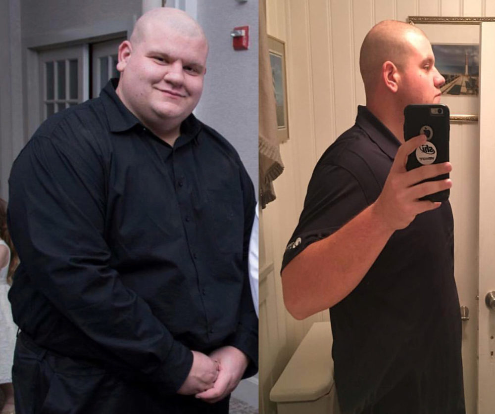Member 2, before (left) and after (right) Fresh Start Nutrition